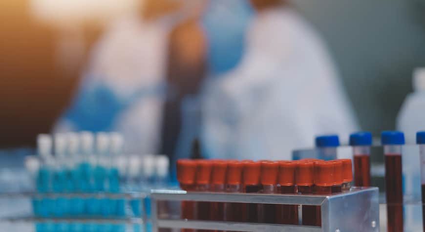 Científicos en laboratorio farmacéutico analizando muestras, contexto de gestión de cartera y reducción del DSO - Profitline