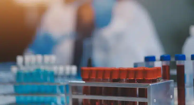 Científicos en laboratorio farmacéutico analizando muestras, contexto de gestión de cartera y reducción del DSO - Profitline